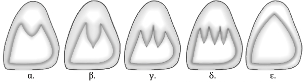 File:The 5 different lingual views of maxillary central incisor.jpg
