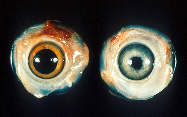 File:Ocular Marek's disease.jpg