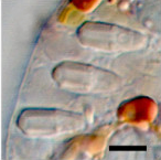 Bmc evol bio hoppenrath Proterythropsis nematocysts fig1f.png