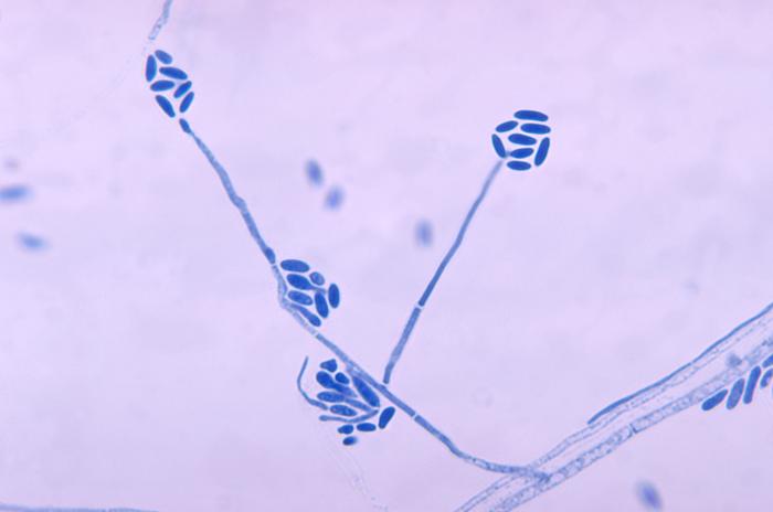 File:Conidia and conidiophores of the fungus Acremonium falciforme PHIL 4168 lores.jpg
