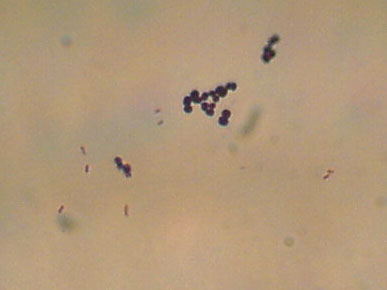File:Gram escherichia coli und micrococcus luteus.jpg