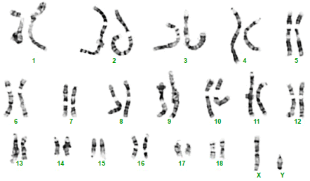 File:Karyotype of normal male pig.png