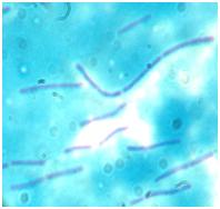 Microscopic Image Lactobacillus bulgaricus GLB44.jpg