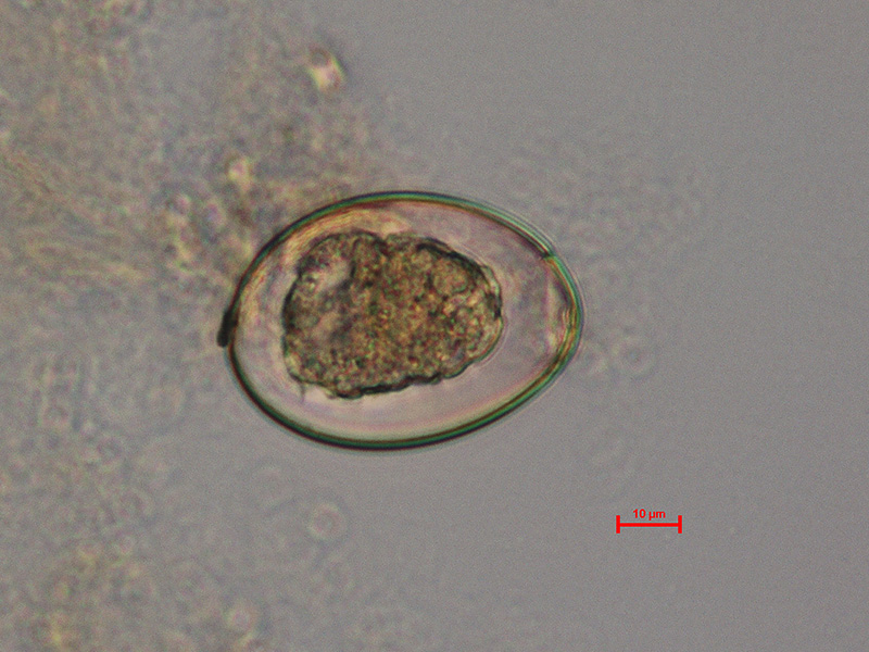File:Diphyllobothrium latum egg.jpg