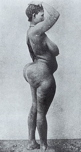 Woman with steatopygia.jpg