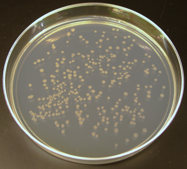 File:Ecoli colonies.png