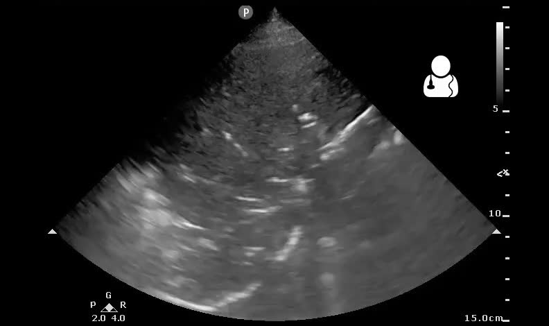 File:UOTW 34 - Ultrasound of the Week 3.jpg