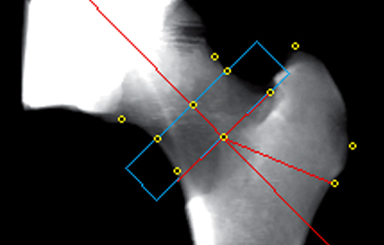 File:Image of proximal femur bone projection.jpg