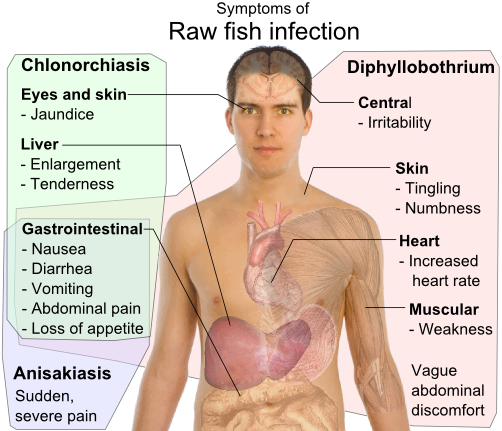 File:Symptoms of Raw fish infection.png