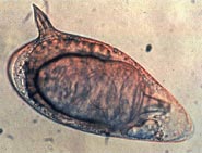 File:Schistosoma mansoni.jpg