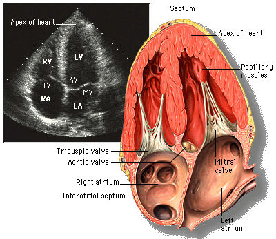 File:Apical 4 chamber view.png