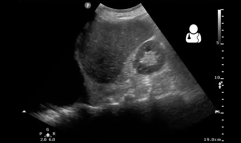 File:UOTW 38 - Ultrasound of the Week 4.jpg