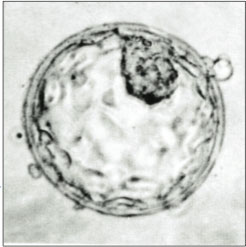 Human blastocyst.jpg