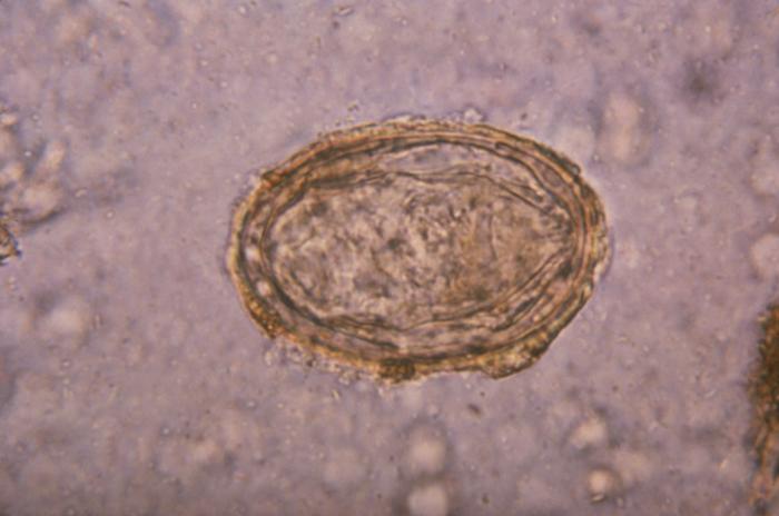 File:Schistosoma haematobium egg 4842 lores.jpg