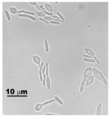 File:Phase contrast micrograph of the yeast form of Sporothrix schenckii.png