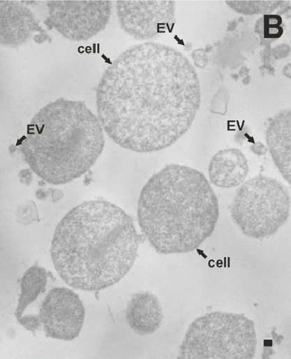 File:Acholeplasma laidlawii PG8 Cells and EVs (cropped).jpg