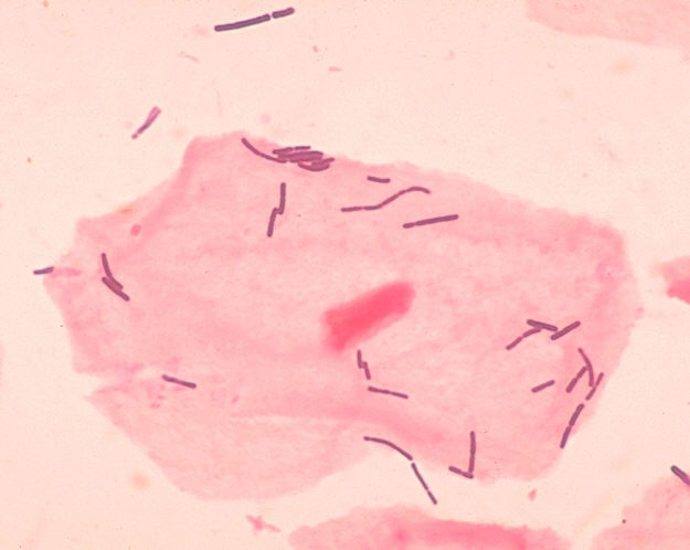 File:Lactobacillus sp 01.png