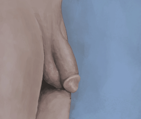 File:Penile implant in action.gif