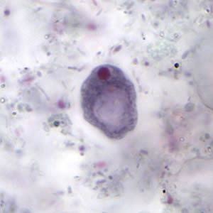 I.Butschlii-cysts1.jpg