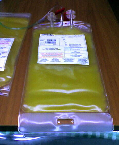 File:Platelet blood bag.jpg