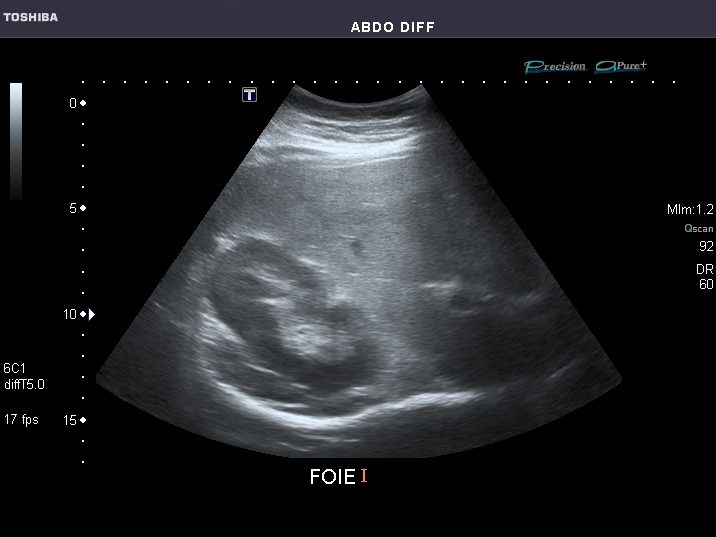File:Abdominal Ultrasound Full Exam 05.jpg