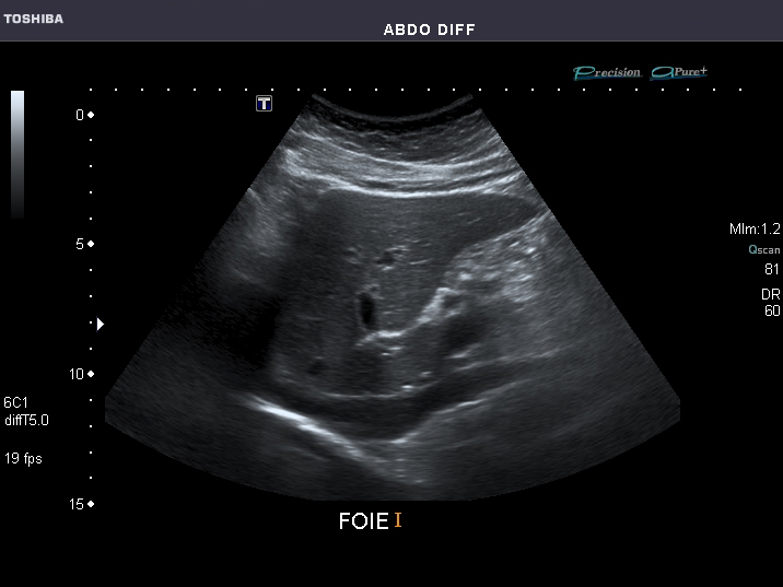 File:Abdominal Ultrasound Full Exam 02.jpg