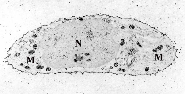 File:Chondrocyte- calcium stain.jpg