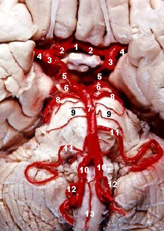 File:Human brainstem blood supply description.JPG
