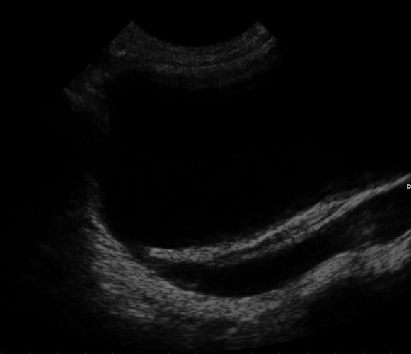 File:Ultrasound Scan ND 0119092150 0939241.png