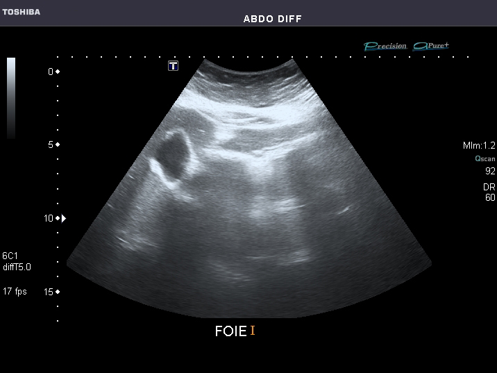 File:Abdominal Ultrasound Full Exam 09.jpg