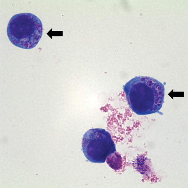 File:Anaplasma phagocytophilum cultured in human promyelocytic cell line HL-60.jpg