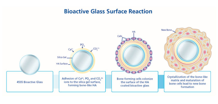 File:Bioglass Surface Reaction.jpg