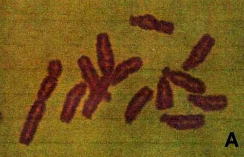 File:Karyotype of Broad bean (Vicia faba).png