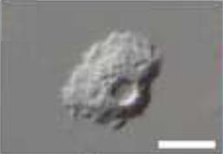 Luapeleamoeba arachisporum L.png