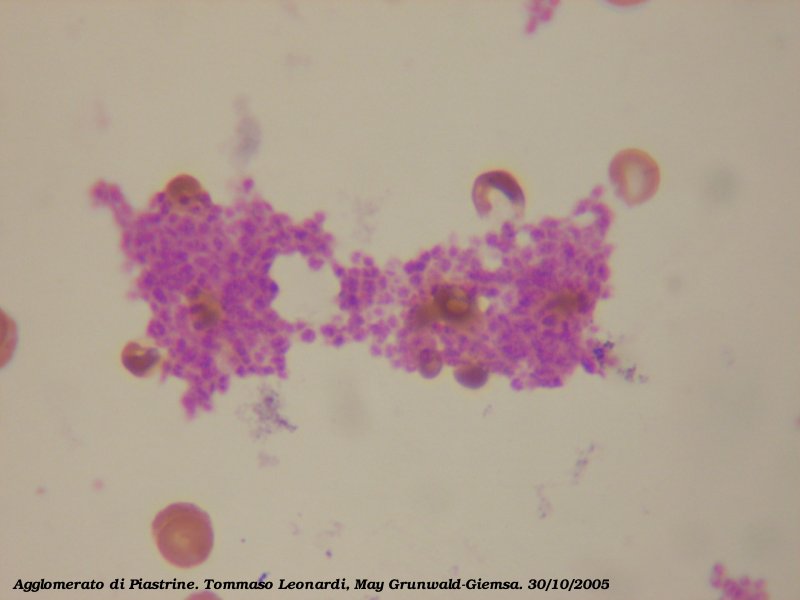 File:Platelets.jpg