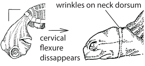 File:T2. Cervical flexure disappeared (T01b).png