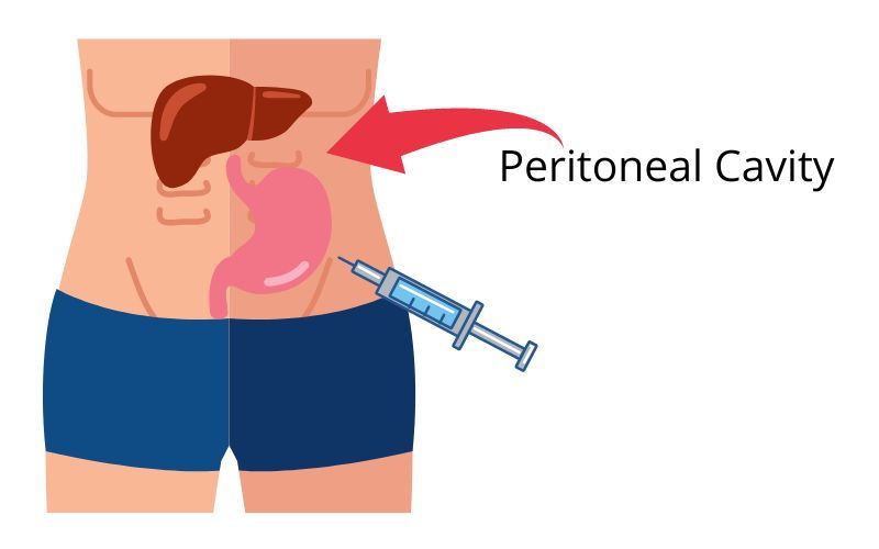 File:Peritoneal Cavity Human1.jpg
