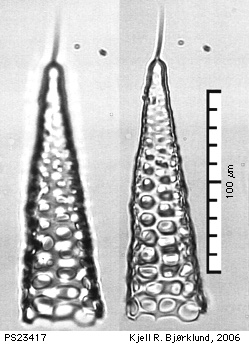 Cornutella profunda Under Microscope.jpg