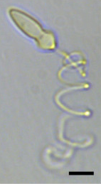 Bmc evol bio hoppenrath Polykrikos kofoidii extruded nematocyst fig1l.png