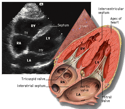 File:Subcostal view of heart.gif