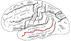 A black and white line drawing of the cerebrum that includes labels of each gyri and sulci. The Superior Temporal Sulcus is highlighted in red.