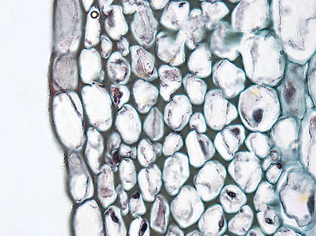File:Plant cell type collenchyma.png