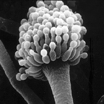 Electron micrograph picture of Aspergillus fumigatus