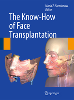 The Know-How of Face Transplantation.jpg