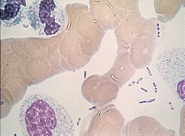 File:Yersinia pestis wayson.jpg