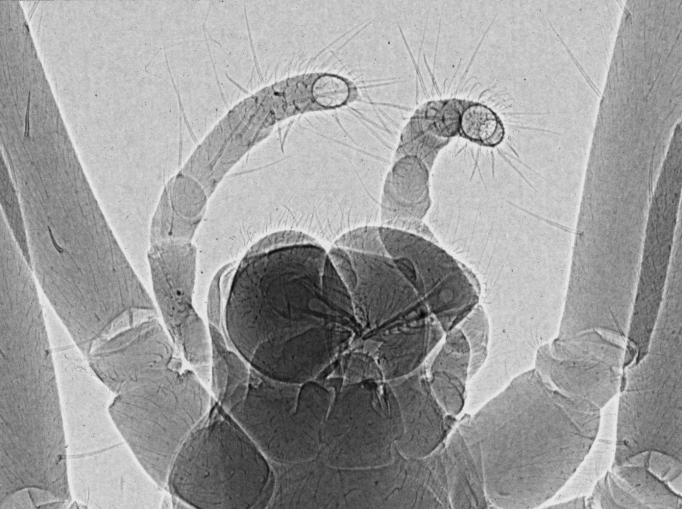 File:Phase-contrast x-ray image of spider.jpg