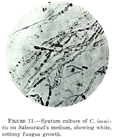 File:Coccidioides immitis on Sabouraud's medium.jpg