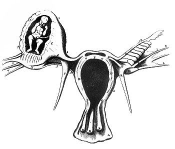 File:Ectopic.png