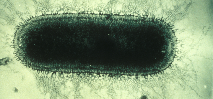 File:Electron microscope image of rabies virus.jpg