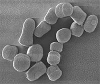 SEM of Arthrobacter chlorophenolicus.jpg